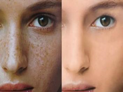 2023年武漢醫(yī)療機(jī)構(gòu)排行榜揭曉！探究光纖溶脂瘦臀部美容醫(yī)院的絕佳選擇。