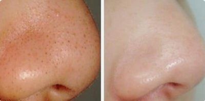 北京彩光嫩膚哪家醫(yī)院好的口碑最佳，推薦【2023年最新版】