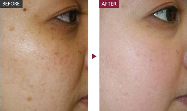 【上海抽脂減肥哪家醫(yī)院好】專業(yè)大型醫(yī)療機構推薦，值得信賴！