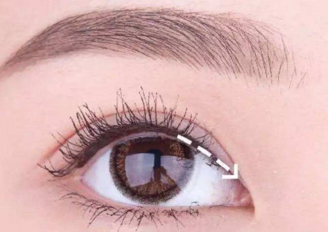 武漢眼睛修復(fù)哪家醫(yī)院好？專家推薦的眼科修復(fù)機構(gòu)有哪些？