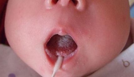 濟(jì)南整容醫(yī)院哪家隆鼻好？濟(jì)南整形醫(yī)院排行榜2023新鮮出爐！