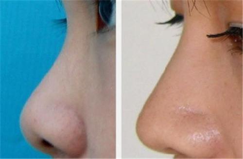 南昌大學醫(yī)學院醫(yī)療整形美容醫(yī)院團隊技術如何？他們的整形技術一覽如何呢？