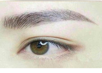 什么是雙眼皮手術(shù)的詳細(xì)過程？