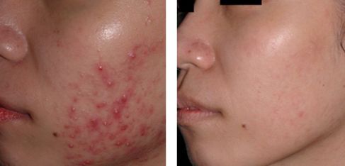 沈陽有哪些知名整形醫(yī)院？公立和私立機構(gòu)齊備！