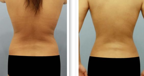 長春切包皮哪家醫(yī)院好？專家推薦的長春男科醫(yī)院排名及費(fèi)用解析