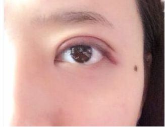 荊州整容哪家醫(yī)院好？