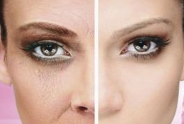 淄博哪家整形醫(yī)院的祛眼袋效果最佳，體驗(yàn)口碑推薦！