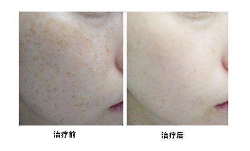 2023南昌漏斗胸矯正治療美容醫(yī)院排行榜揭曉！推薦十家醫(yī)院！