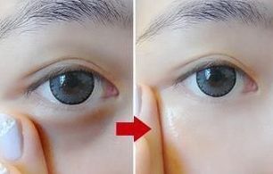 蘇州皮秒激光醫(yī)院哪家好？如何選擇適合自己的蘇州皮秒激光醫(yī)院