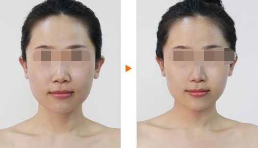 武漢包皮手術(shù)哪家醫(yī)院好？排行榜前十強(qiáng)推薦！