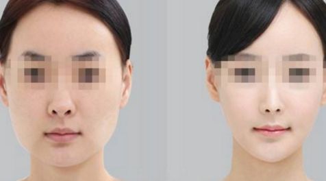 貴陽市哪家鼻子整形醫(yī)院排名靠前？