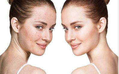 南京哪家醫(yī)院激光祛黑眼圈效果好？排名前十強(qiáng)醫(yī)療整形機(jī)構(gòu)盤點(diǎn)