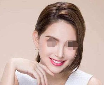 廈門2023年鼻子好的醫(yī)院對(duì)比：美萊、蓓蕾斯特與思明區(qū)黃巖實(shí)力對(duì)抗！