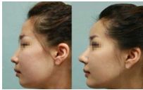 常州哪家整形外科醫(yī)院做鼻子好？這三家給出新答案