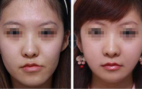 北京痘疤整形醫(yī)院排名前十盤點(diǎn)！