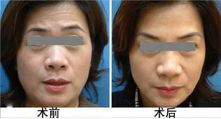 中國耳贅整形醫(yī)院口碑排行榜：十家精品機(jī)構(gòu)揭秘