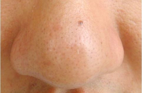 廈門少女針美容醫(yī)院排名及口碑大揭秘