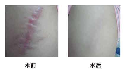 2023年北京納米脂肪面部年輕化領(lǐng)先的十大美容醫(yī)院評(píng)選出爐！