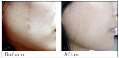 海南眼部皺紋去除醫(yī)院排行榜發(fā)布：前10家醫(yī)院盤點(diǎn)