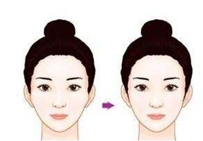 豐唇后的恢復(fù)時(shí)長(zhǎng)及經(jīng)歷分享，解密玻尿酸豐唇的自然效果