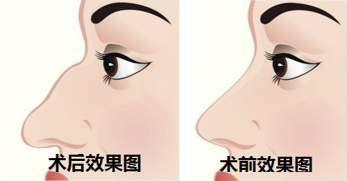 昆明美伊萊醫(yī)療美容門(mén)診部的醫(yī)生技術(shù)好嗎？他們擅長(zhǎng)哪些項(xiàng)目推薦？