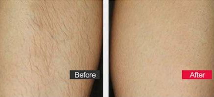 上海最受歡迎的整容醫(yī)院有哪些？