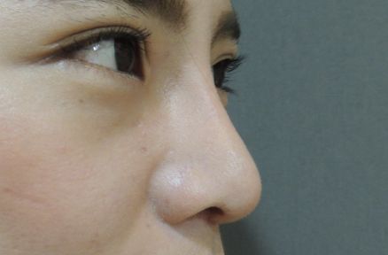 遼陽(yáng)鼻子問(wèn)題?？漆t(yī)院有哪些？哪家醫(yī)院看鼻子好？