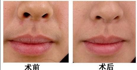 南昌哪家醫(yī)院做美容好的？選擇南昌醫(yī)院美容中心，享受頂級服務(wù)