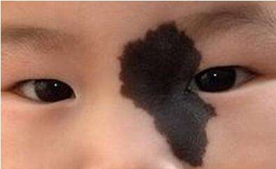 長沙水光針哪家醫(yī)院好？綜合排名前五的長沙水光針醫(yī)院推薦！