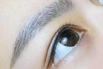 光子嫩膚去痘真的有效嗎？效果能保持多久？