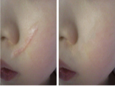 西南醫(yī)院美容整形科醫(yī)生哪些項(xiàng)目擅長？想要美容整形的人可以去嗎？