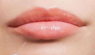 濱州脫毛效果好的醫(yī)院都在哪里？去哪家醫(yī)院脫毛效果更好呢？