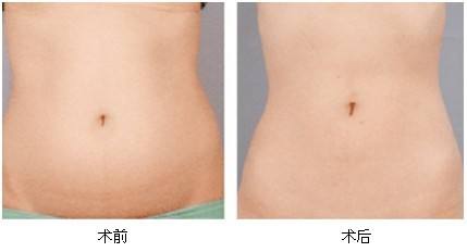 深圳光電治療打眼紋醫(yī)療整形醫(yī)院排行榜前10，口碑比較