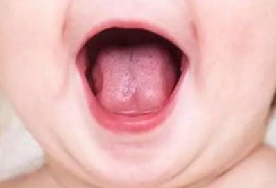 北京看腋臭哪家醫(yī)院效果好？腋下異味專家為您解答！