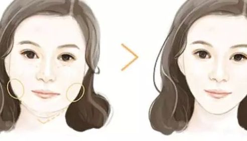 濟(jì)南眼底玻尿酸填充十佳醫(yī)美機(jī)構(gòu)榜單