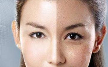 宜昌哪家醫(yī)院除魚尾紋好？挑選適合自己的專業(yè)醫(yī)院！