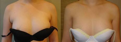 林允兒近期狀態(tài)有何變化？照片來(lái)看，31歲的她到底何去何從？