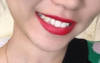 哈爾濱公立整形醫(yī)院哪家效果好？手術(shù)價(jià)格免費(fèi)查詢，你了解哪家比較靠譜？