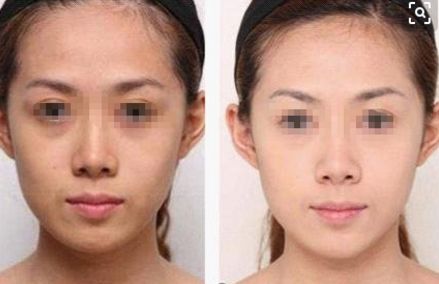 成都專業(yè)激光點(diǎn)痣醫(yī)院推薦，2024年精選榜單