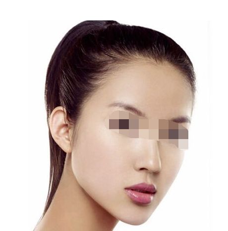 面部輪廓整形：顴骨磨骨+吸脂提升臉型，煥發(fā)全新魅力