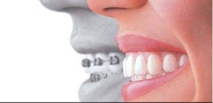 監(jiān)利白衣天使醫(yī)療美容指南：特色項(xiàng)目、費(fèi)用詳解