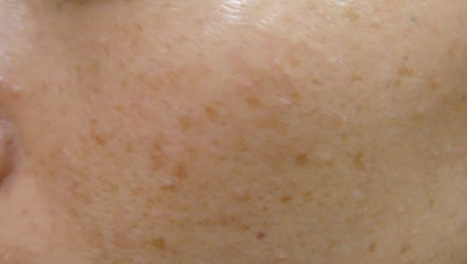 杭州三甲級(jí)醫(yī)院中，哪家擁有最專業(yè)的豐胸醫(yī)療團(tuán)隊(duì)？