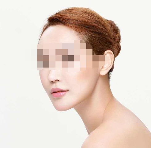 成都吸脂塑身醫(yī)院全方位指南：口碑、技術(shù)、案例解析