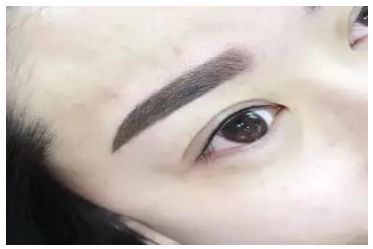 徐子珊再次為外貌進行整容引來熱議，她取得怎樣的效果？