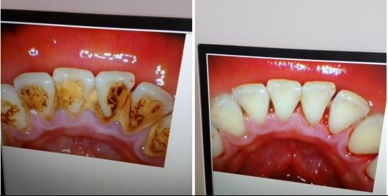 南寧哪家瘦臉針醫(yī)院好？頂級整形專家告訴你！