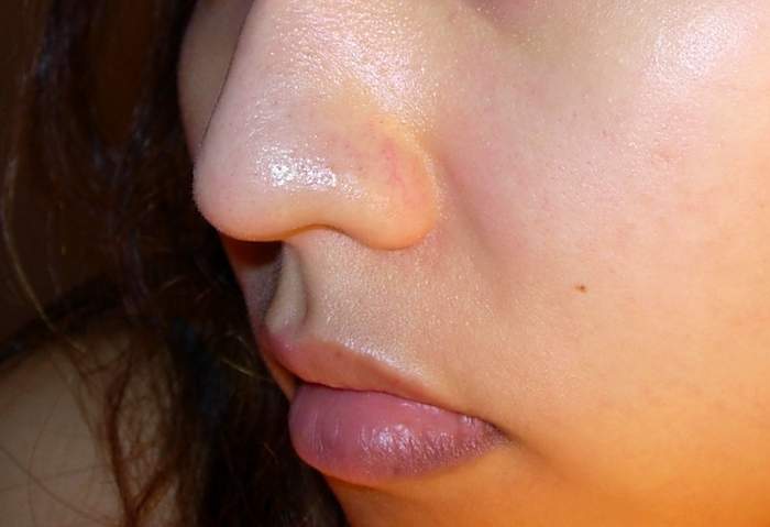 泉州脂管加醫(yī)療美容門診部的資質(zhì)如何？是否擁有優(yōu)秀的醫(yī)生團(tuán)隊(duì)和口碑佳的醫(yī)院？