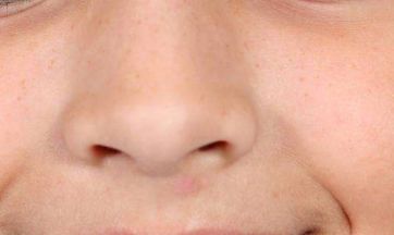 【Top醫(yī)院】2023杭州激光祛斑醫(yī)美推薦，了解價格、口碑！