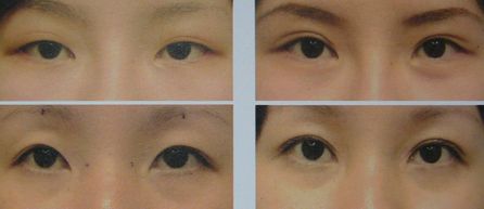 蘭州更受歡迎的除皺整形醫(yī)院排行榜，實力醫(yī)療機構力薦，技術水平贊譽不斷！