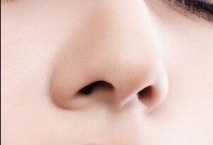 深圳微整形哪家醫(yī)院好？2023年深圳微整形好評(píng)醫(yī)院TOP5推薦