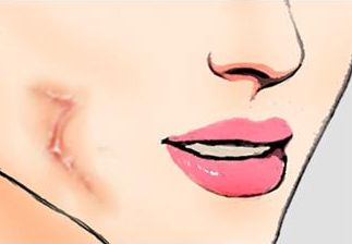 昆明市雙眼皮手術(shù)前5家醫(yī)療機(jī)構(gòu)評比